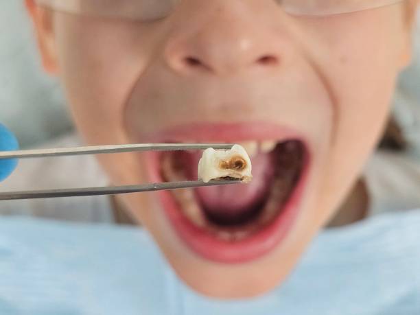 Best Emergency Dental Services for Seniors in Chevy Chase Village, MD
